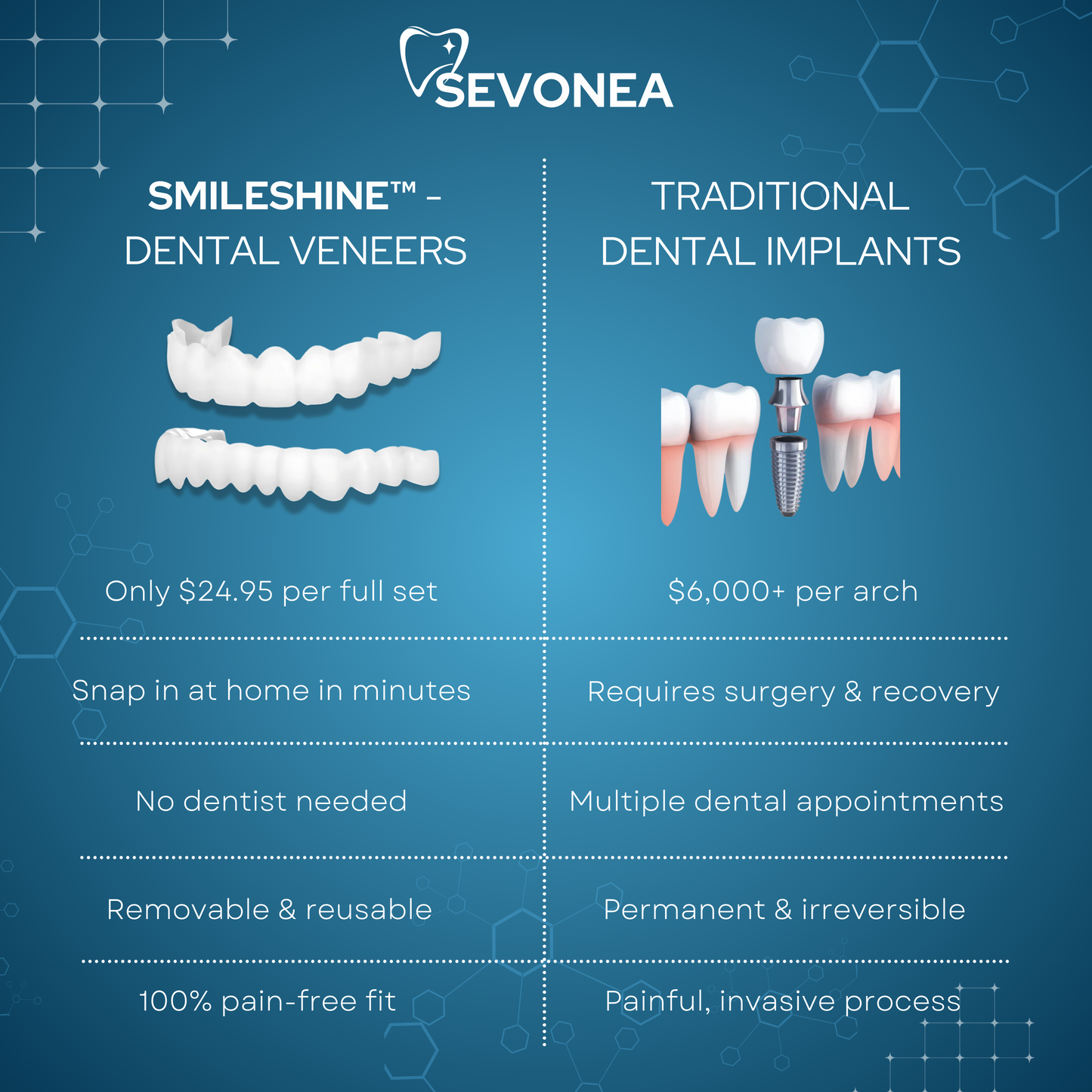 SmileShine™ Dental Veneers
